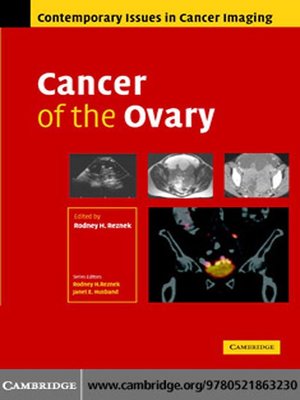 cover image of Cancer of the Ovary